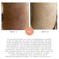 Hydrate & Calm Balm (was Baby & Child)